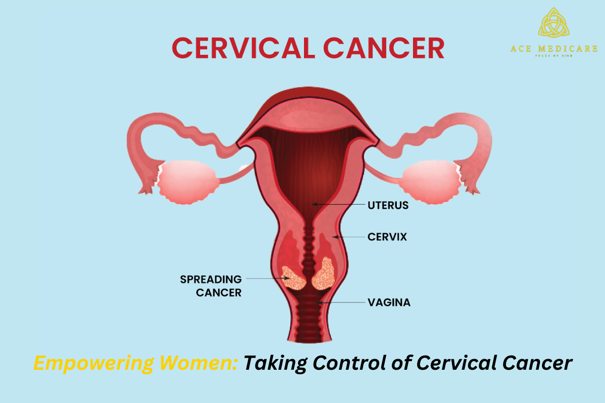 Empowering Women: Taking Control of Cervical Cancer